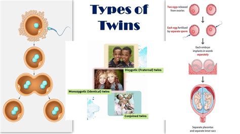 pictures of fraternal twins|fraternal twins vs identical.